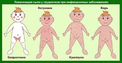 Різниця між кт і узі (використовуються рентгенівські промені) Різниця між кт і узі