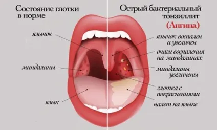 Дитина кашляє, коли спить що робити батькам у цій ситуації (кашляє) Дитина кашляє, коли спить що робити батькам у цій ситуації