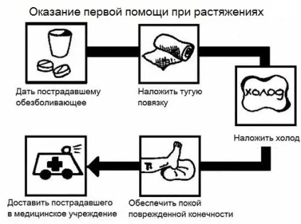 Розтягнення зв'язок зап'ястя руки симптоми і лікування (зап'ястя) Розтягнення зв'язок зап'ястя руки симптоми і лікування