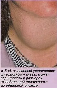 Щитовидна і паращитовидної залози (знання - анатомія людини) (тироксин) Щитовидна і паращитовидної залози (знання - анатомія людини)