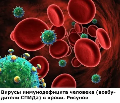 Сепсис крові - симптоми, лікування, наслідки (наслідки) Сепсис крові - симптоми, лікування, наслідки