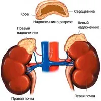 Синдром Іценко-Кушинга симптоми і лікування хвороби Іценко-Кушинга