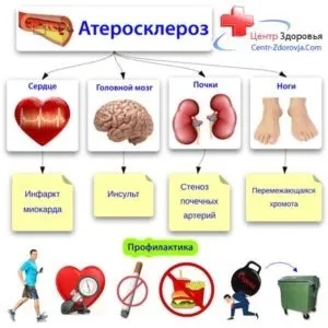 Сильне запаморочення у людей похилого віку - лікування, препарати і народ (людей) Сильне запаморочення у людей похилого віку - лікування, препарати і народ