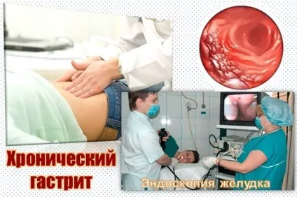 Симптоми хронічного гастриту
