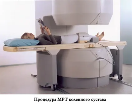 Синовит суть хвороби, причини, симптоми, діагностика та лікування (причини) Синовит суть хвороби, причини, симптоми, діагностика та лікування