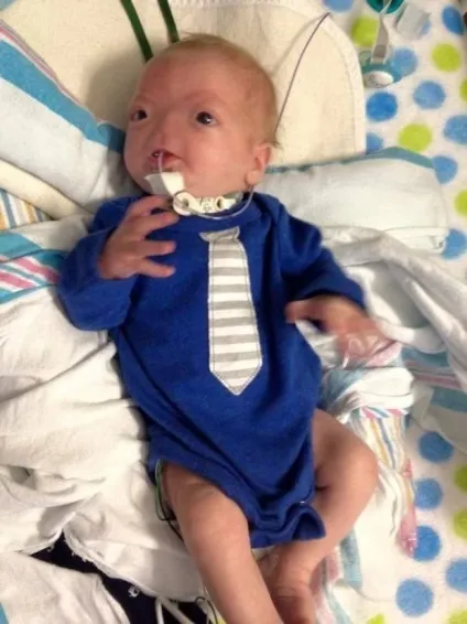 Шок! Дитина, яка народилася без носа! Неймовірні факти (народився) Шок! Дитина, яка народилася без носа! Неймовірні факти