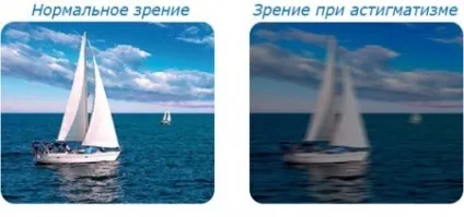 Змішаний астигматизм і три основні шляхи його лікування
