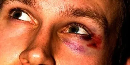 Сонник побитий чоловік до чого сниться побитий чоловік уві сні (побитий) Сонник побитий чоловік до чого сниться побитий чоловік уві сні