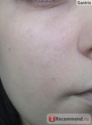 Тональний крем clinique redness solutions makeup spf 15 - «добре поводиться на шкірі, але викликав (redness) Тональний крем clinique redness solutions makeup spf 15 - «добре поводиться на шкірі, але викликав