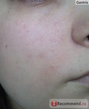 Тональний крем clinique redness solutions makeup spf 15 - «добре поводиться на шкірі, але викликав (redness) Тональний крем clinique redness solutions makeup spf 15 - «добре поводиться на шкірі, але викликав