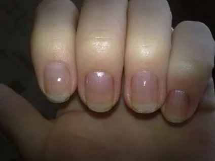 Зміцнення нігтів з orly nail defense відгуки (нігтів) Зміцнення нігтів з orly nail defense відгуки