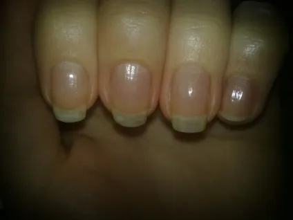 Зміцнення нігтів з orly nail defense відгуки (nail) Зміцнення нігтів з orly nail defense відгуки