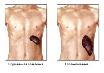 Узі черевної області що входить (входить) Узі черевної області що входить