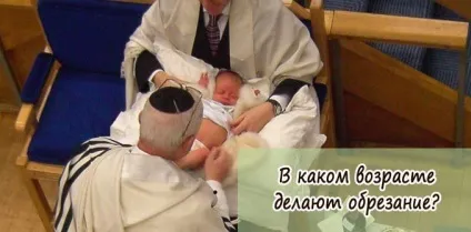В якому віці роблять обрізання хлопчикам (обрізання) В якому віці роблять обрізання хлопчикам