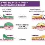 Віск або шугарінг що краще