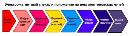 Шкода рентгена, шкода кт для організму, наскільки шкідливий рентген, чим небезпечний рентген, наскільки (рентген) Шкода рентгена, шкода кт для організму, наскільки шкідливий рентген, чим небезпечний рентген, наскільки