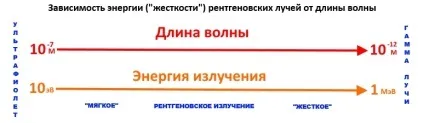 Шкода рентгена, шкода кт для організму, наскільки шкідливий рентген, чим небезпечний рентген, наскільки (наскільки) Шкода рентгена, шкода кт для організму, наскільки шкідливий рентген, чим небезпечний рентген, наскільки