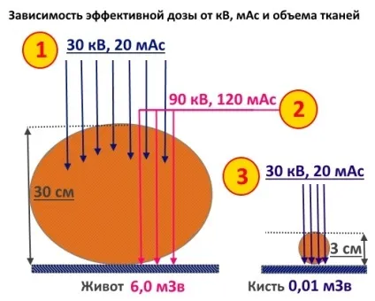 Шкода рентгена, шкода кт для організму, наскільки шкідливий рентген, чим небезпечний рентген, наскільки (наскільки) Шкода рентгена, шкода кт для організму, наскільки шкідливий рентген, чим небезпечний рентген, наскільки