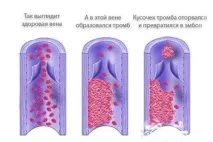 Сушіння організму для схуднення - Спорт спорт