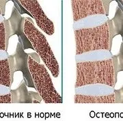 Все про хребет