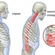 Все про хребет