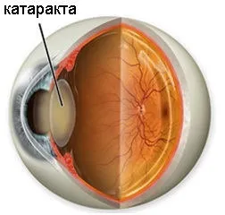кришталик ока