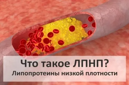 Холестерин ЛПНЩ підвищений що це означає (холестерин) Холестерин ЛПНЩ підвищений що це значить