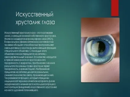 Заміна кришталика ока при катаракті - вартість операції (фото, відео) (кришталика) Заміна кришталика ока при катаракті - вартість операції (фото, відео)