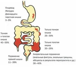Аутоіммунна алергія - як розвивається, симптоми і причини (алергія) Аутоіммунна алергія - як розвивається, симптоми і причини