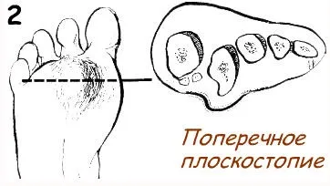 Анатомія стопи людини