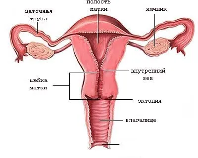 Ектопія шийки матки, що це таке, причини, симптоми, цервікальна ектопія епітелію шийки матки у (що це таке) Ектопія шийки матки, що це таке, причини, симптоми, цервікальна ектопія епітелію шийки матки у
