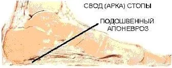 Як лікують п'яткову шпору, центр Дикуля (п'яткову) Як лікують п'яткову шпору, центр Дикуля