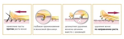 Як наносити шугарінг в домашніх умовах, правильна техніка (наносити) Як наносити шугарінг в домашніх умовах, правильна техніка