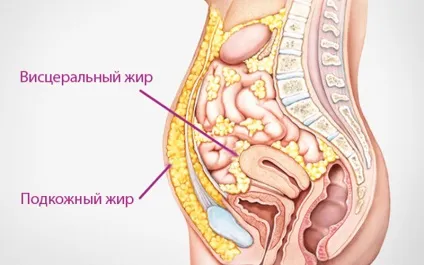 Як прибрати вісцеральний жир на животі (прибрати) Як прибрати вісцеральний жир на животі