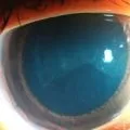 Як захиститися від пристріту і псування самостійно (самостійно) Як захиститися від пристріту і псування самостійно