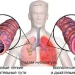 Кращі народні засоби від кашлю - перевірені рецепти народної медицини (кожні наступні години) Кращі народні засоби від кашлю - перевірені рецепти народної медицини
