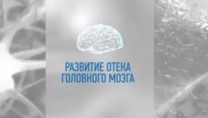Набряк мозку при інсульті прогноз, симптоми (симптоми) Набряк мозку при інсульті прогноз, симптоми
