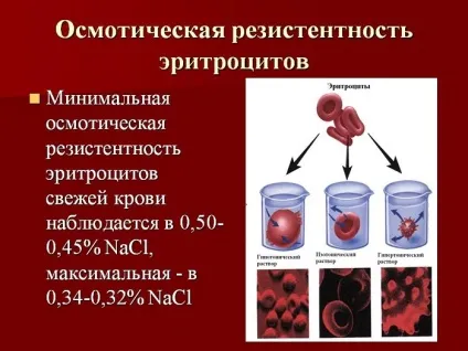 Осмотична або стійка резистентність еритроцитів - що це