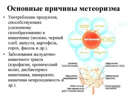 Пневматоз кишечника причини, симптоми і лікування (лікування) Пневматоз кишечника причини, симптоми і лікування