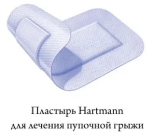 Пупкова грижа у новонароджених - лікування в домашніх умовах бандаж, пластир, масаж (пупкова грижа у новонароджених лікування в домашніх умовах бандаж пластир масаж як заговорити позбутися) Пупкова грижа у новонароджених - лікування в домашніх умовах бандаж, пластир, масаж