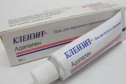Висип на лобі у дорослого, причини вугрового висипання, лікування (лікування) Висип на лобі у дорослого, причини вугрового висипання, лікування