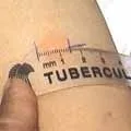 Туберкульоз - пошук слів за маскою та визначенням, відповіді на сканворди туберкульоз