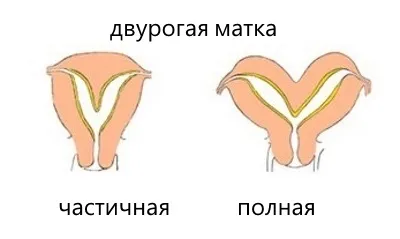 Узі матки, шийки матки і придатків норма розмірів, на який день циклу робити і як (шийки) Узі матки, шийки матки і придатків норма розмірів, на який день циклу робити і як