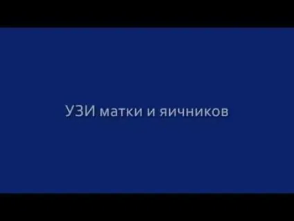 Узі матки, шийки матки і придатків норма розмірів, на який день циклу робити і як (придатків) Узі матки, шийки матки і придатків норма розмірів, на який день циклу робити і як
