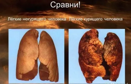 Вплив куріння на дихальну систему, як відновити