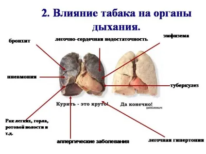 Вплив куріння на дихальну систему, як відновити