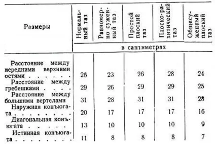 Анатомічно і клінічно вузький таз - як визначають розміри в акушерстві, невідкладна допомога, 1-2 (вузький) Анатомічно і клінічно вузький таз - як визначають розміри в акушерстві, невідкладна допомога, 1-2