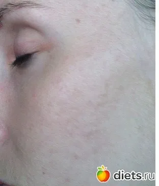 Bb blemish balm від eva mosaic pro красу групи (blemish) Bb blemish balm від eva mosaic pro красу групи