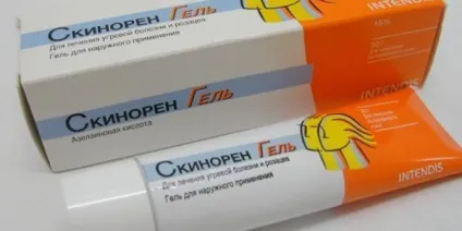 Білі точки на обличчі фото, причини, як від них позбутися (причини) Білі точки на обличчі фото, причини, як від них позбутися