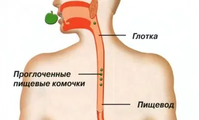 Біль в стравоході при ковтанні причини виникнення (біль) Біль в стравоході при ковтанні причини виникнення